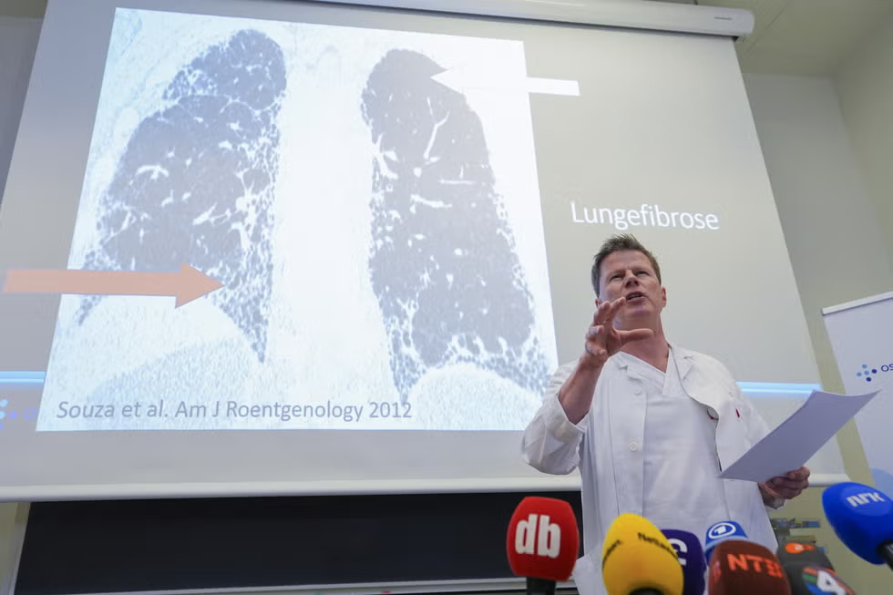 A doctor in a white coat speaks at a press conference in front of a projected lung scan slide labelled 