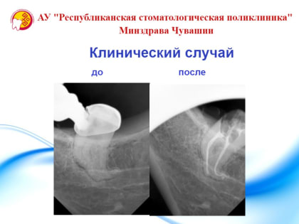 Клинический случай