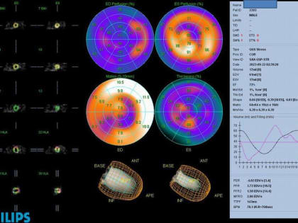 Врачи Чувашии освоили новый метод диагностики заболеваний сердца