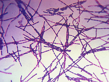 В Чувашии отмечены 2 случая заражения сибирской язвой