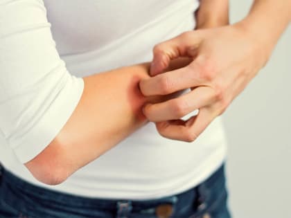 Осторожно, чесотка