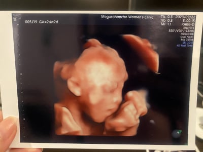 24 weeks. It's a boy!