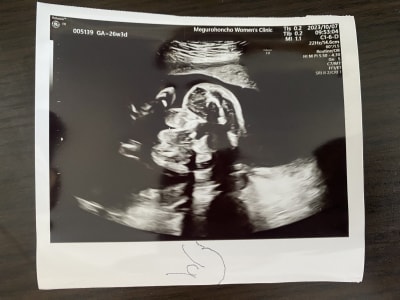 The doctor said you're a boy again!