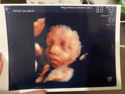 28th week! Cute face