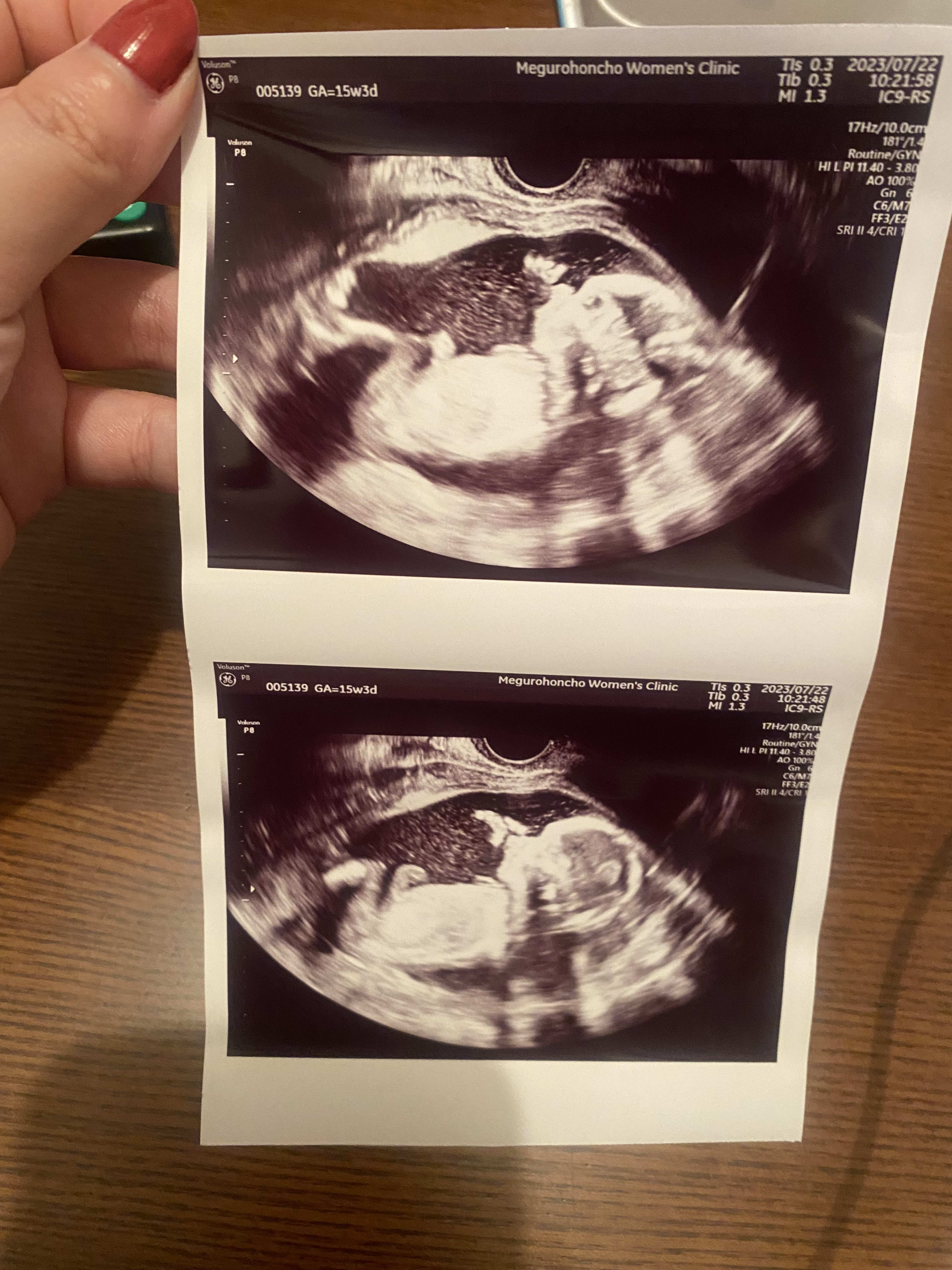 16 weeks!