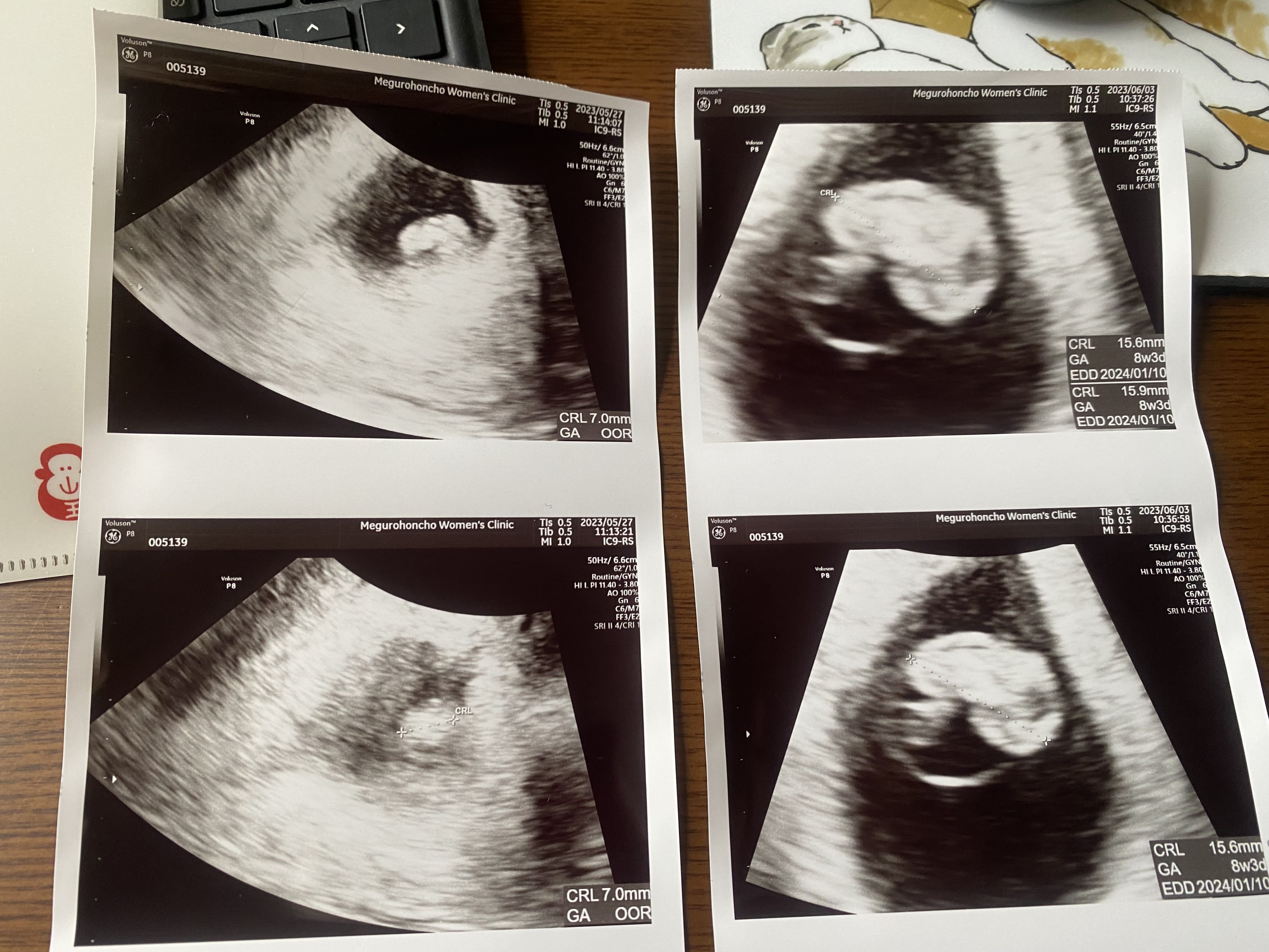 First Photo!