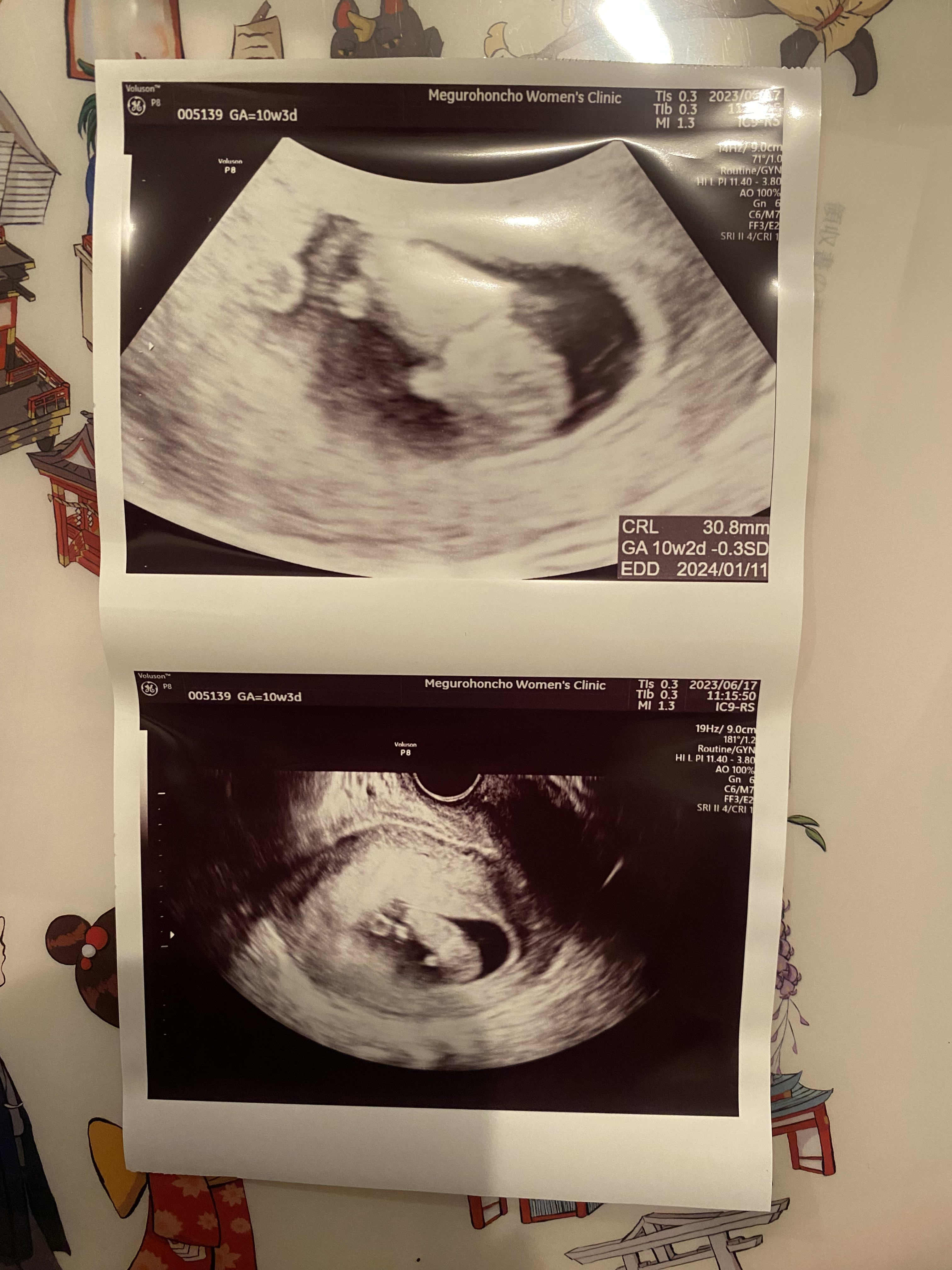 10 weeks!