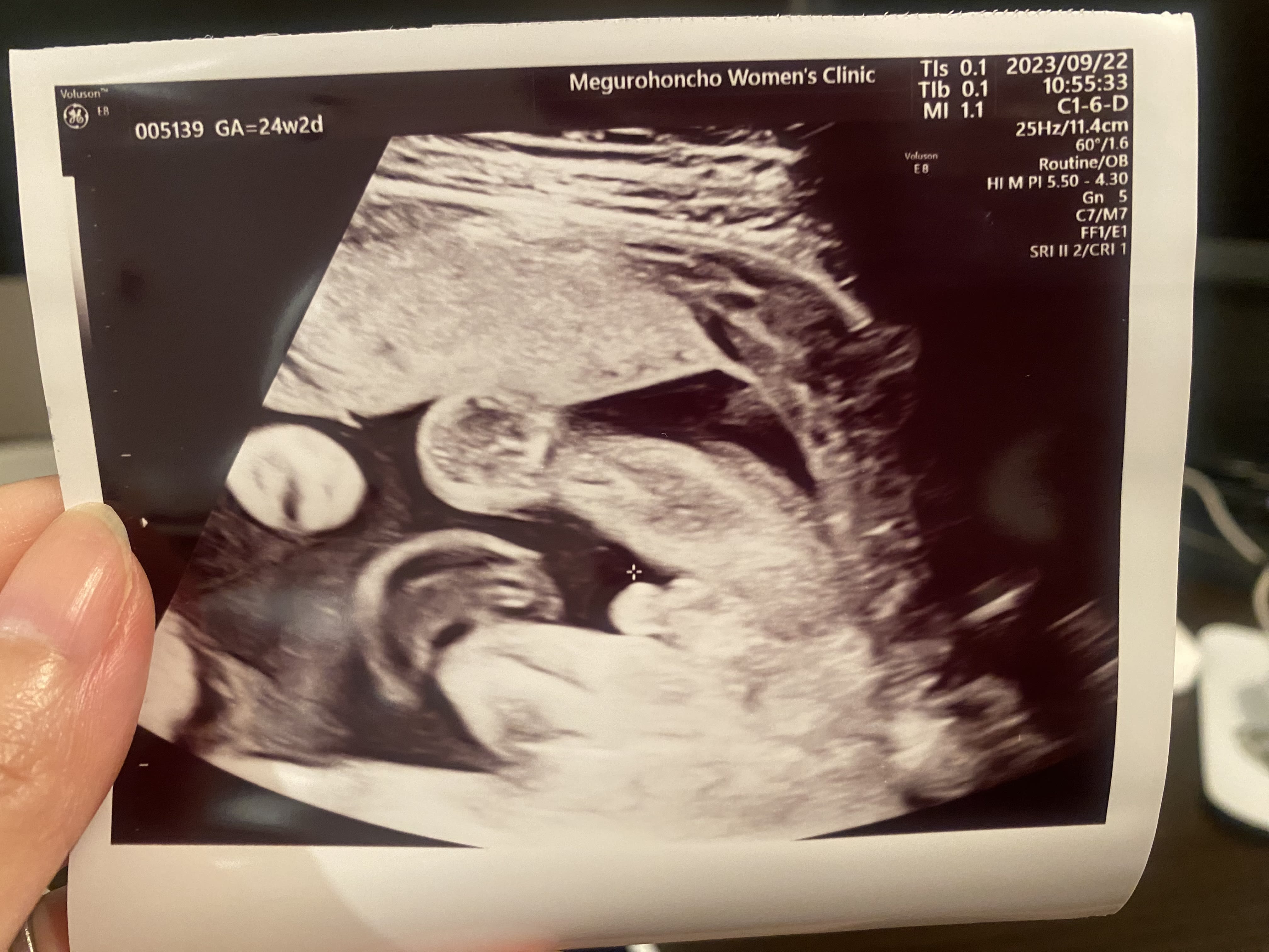 Penis ultrasound