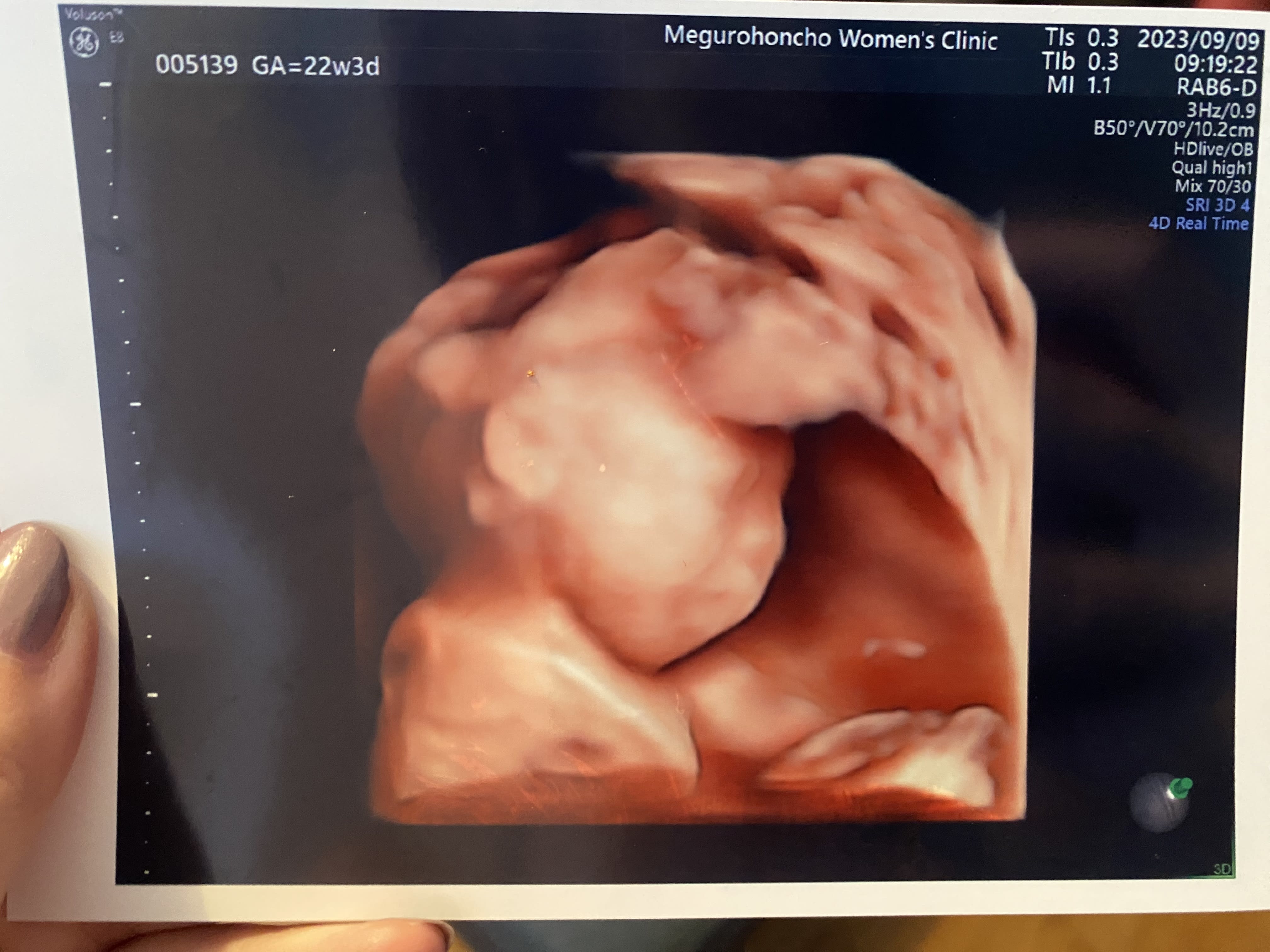 22 weeks!