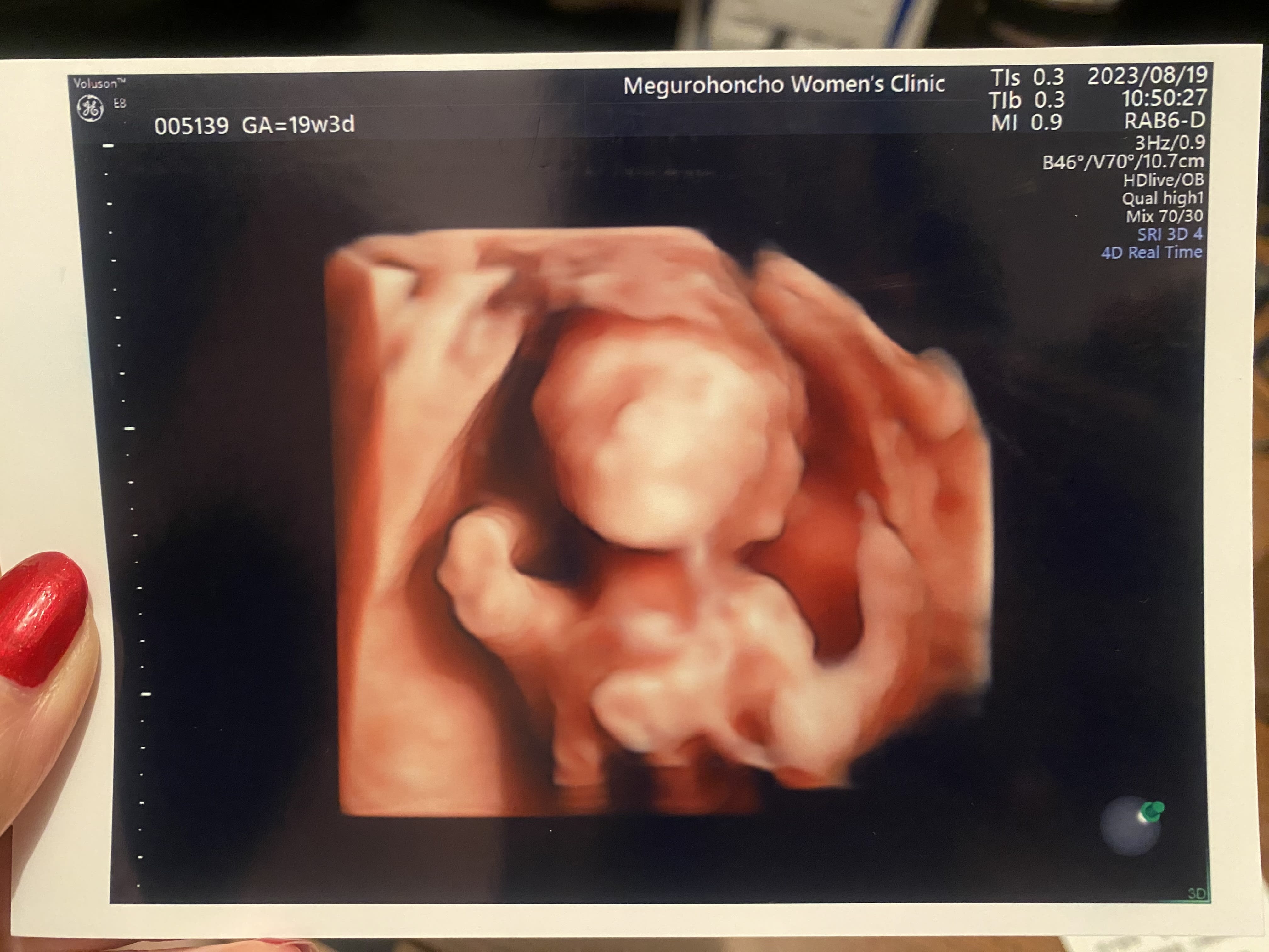 First 4D ultrasound picture!