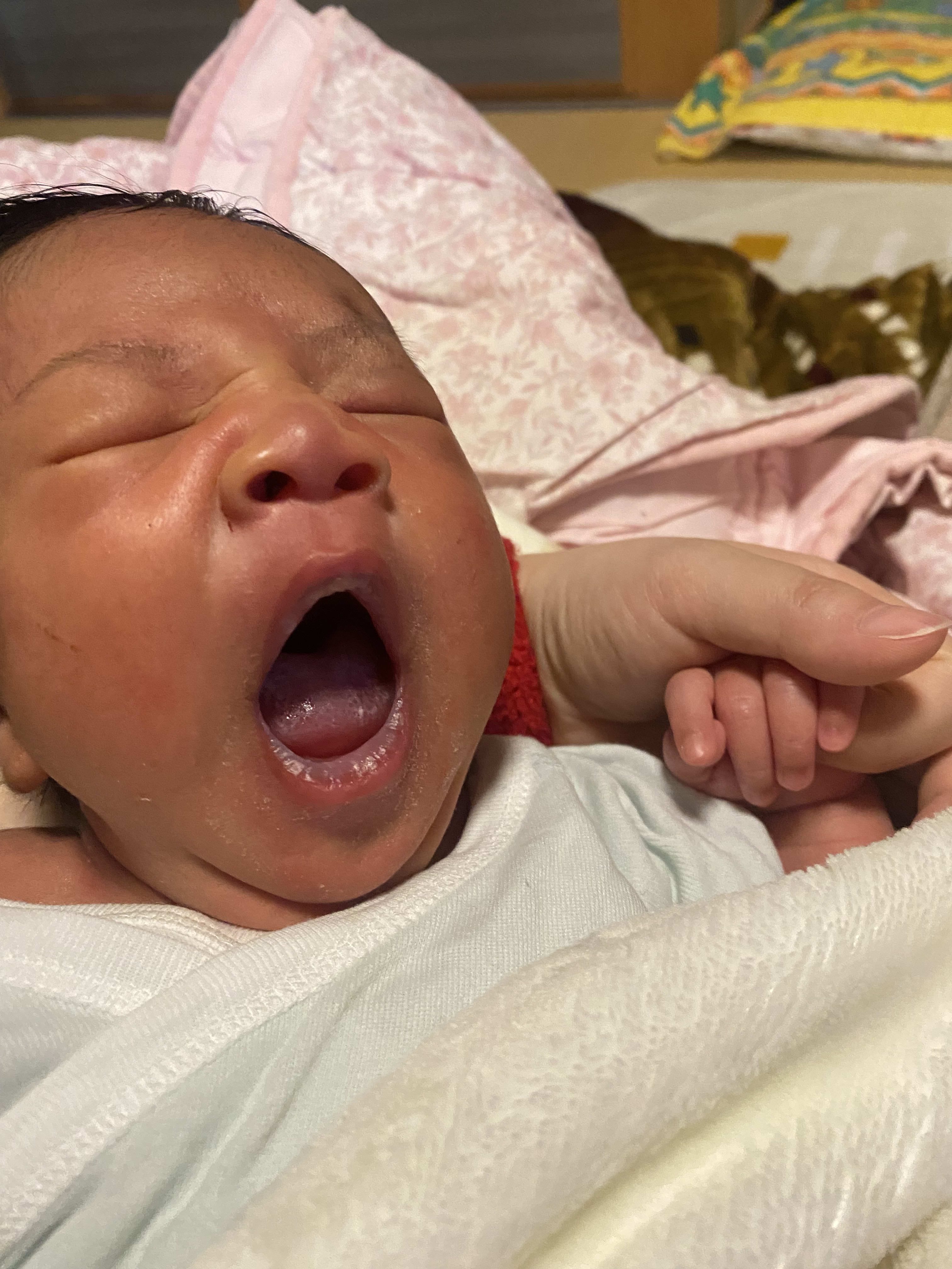 Yawning
