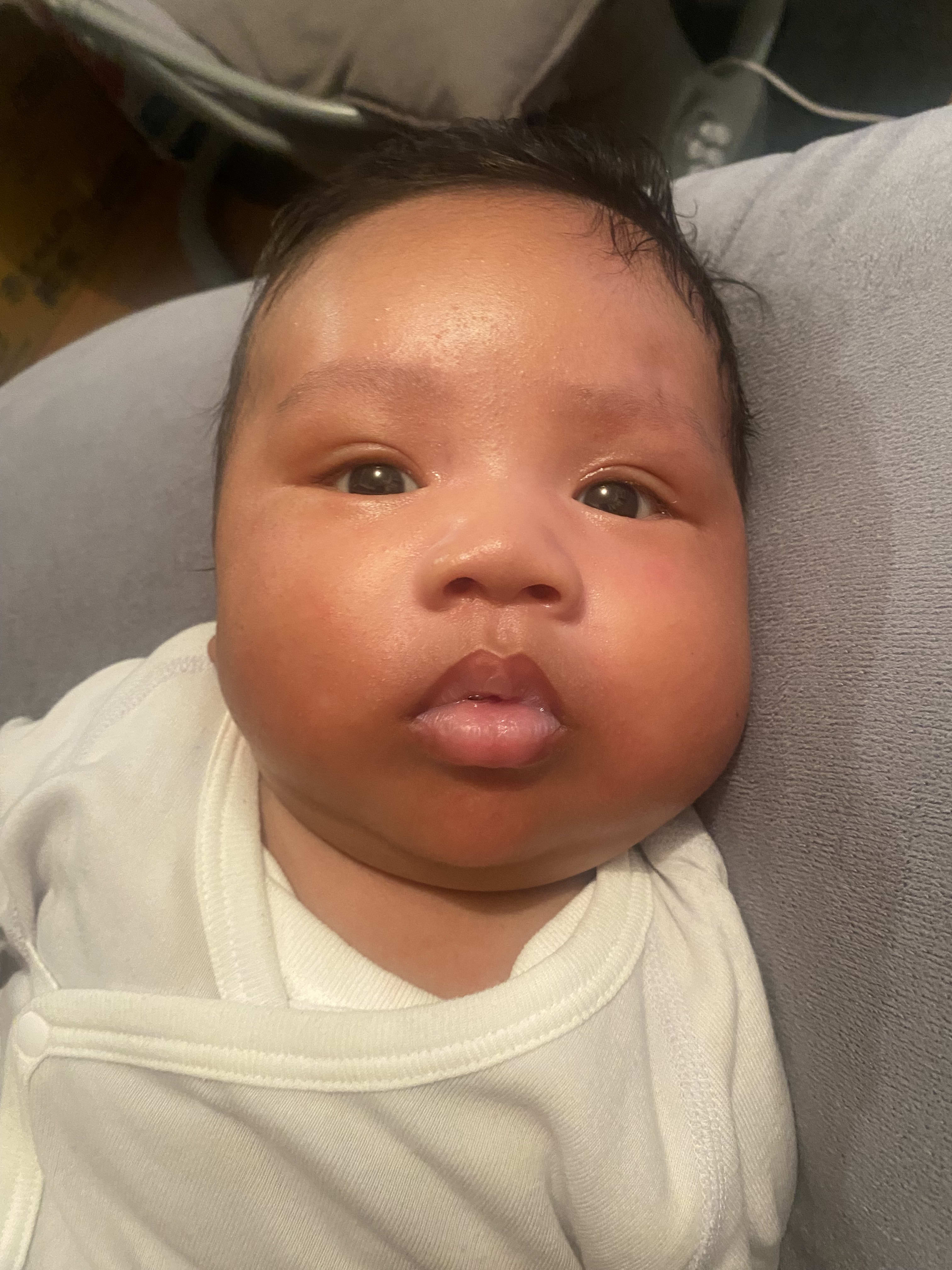 Big cheeks
