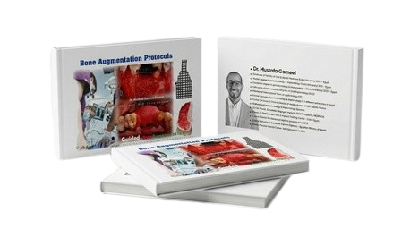 Bone Augmentation Protocols Book