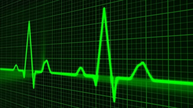 It is hard to find signs of rising inflationary pulse: Westpac's Justin Smirk