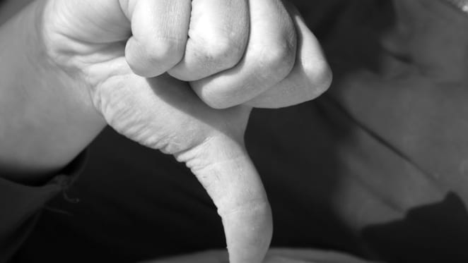 ANZ say just 0.19pp will be passed on to borrowers