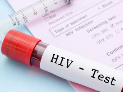 «ВИЧ уже давно болезнь не только наркоманов, лиц, вовлеченных в секс-услуги и гомосексуалистов, сейчас ей болеют и социально-благополучные люди» — специалист