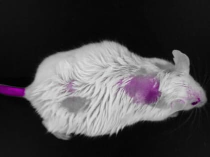 Новый контрастный агент для визуализации опухолей мозга разработан в Красноярске
