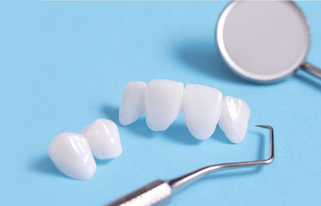 Veneers set on a blue table infront of a dentist