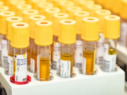 В США и Великобритании одобрили к применению новейший препарат на основе технологии редактирования генов CRISPR