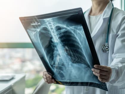Снижение заболеваемости туберкулезом среди детей Смоленской области