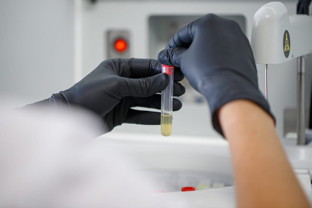 Extracción y manipulación de muestra para análisis clínicos de ByB Laboratorio, con servicio en Villa del Prado