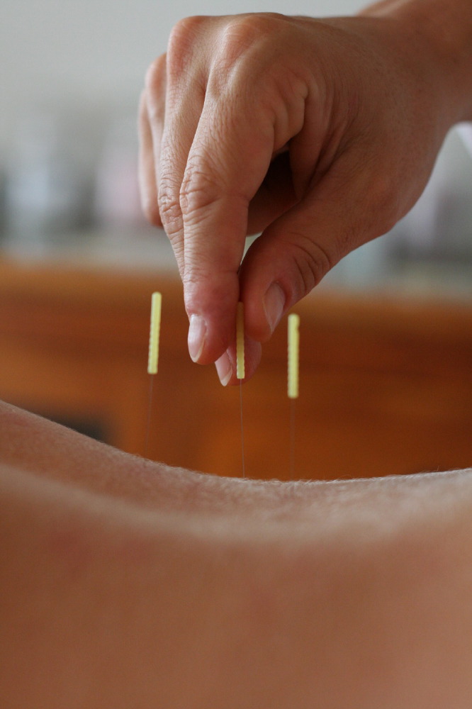 2 the Point Acupuncture spa