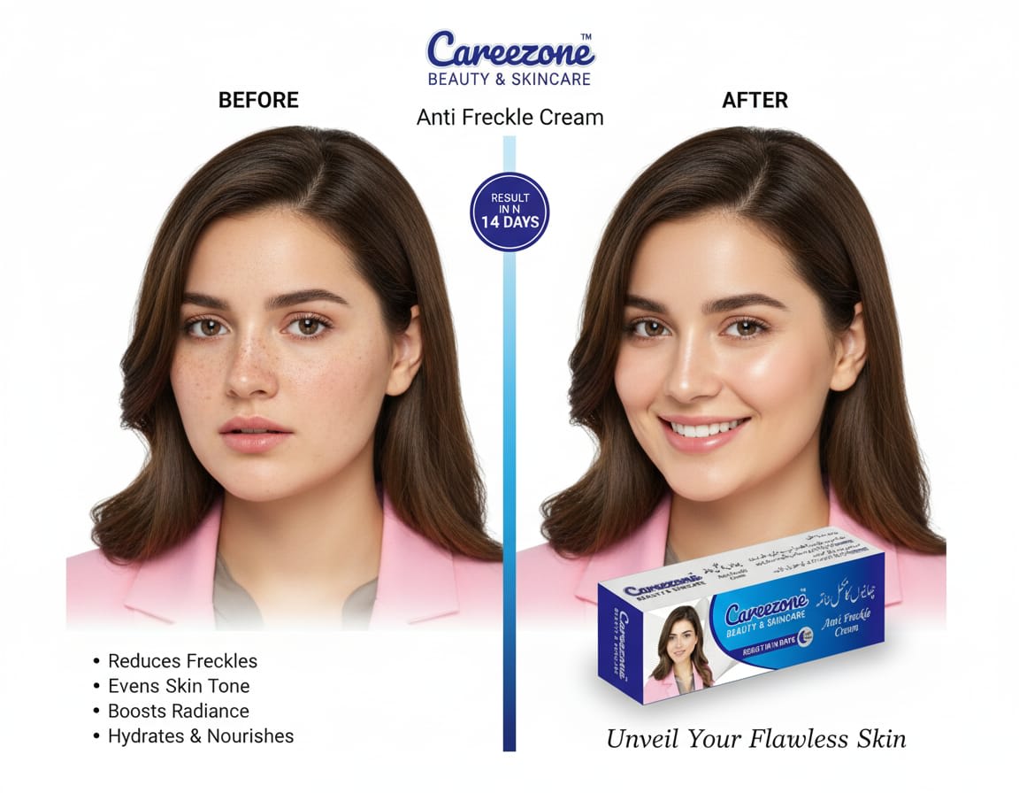 Careezone Anti Freckle Cream — view 1