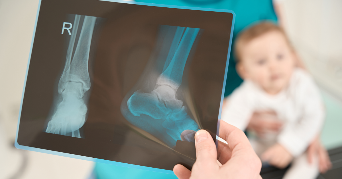 Doctor's hand holding up a right ankle and foot X-ray with a baby visible in the soft-focus background