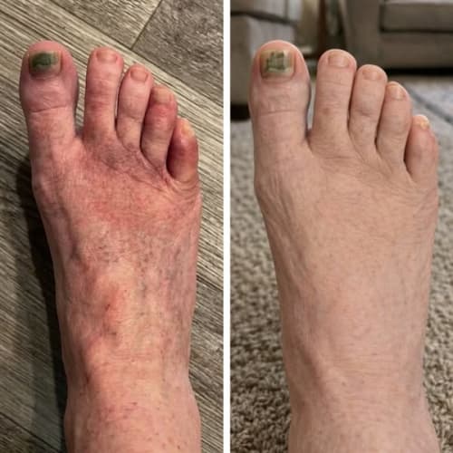 Nerve Pain Relief Community ad
