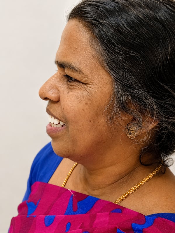After Dental Implants