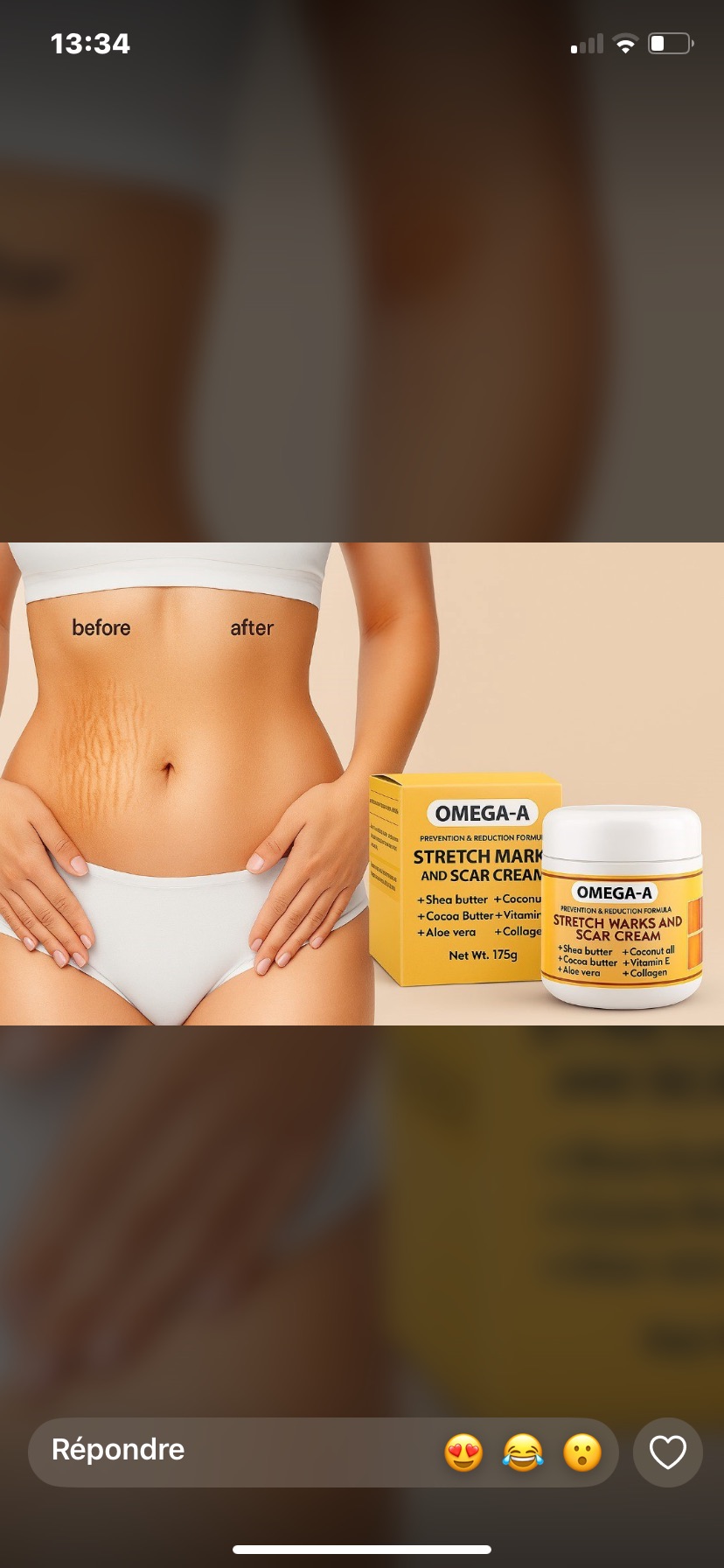 Crème anti vergetures