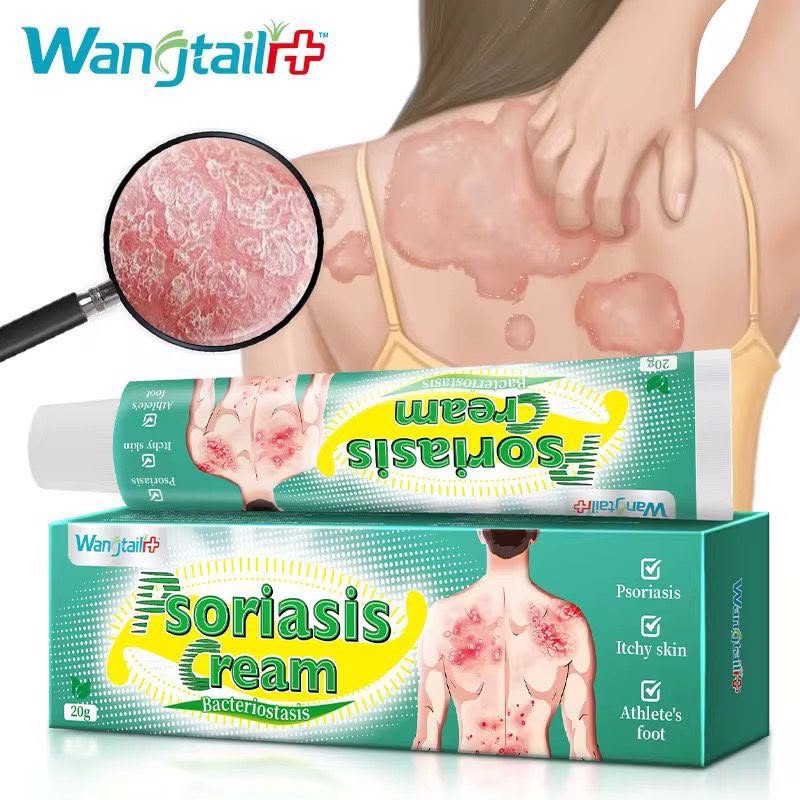 Psoriasis crème 2