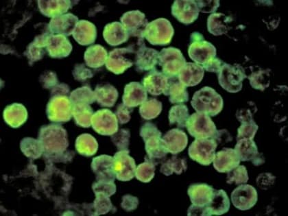 В мире из-за климатических изменений все шире распространяются амебы-мозгоеды