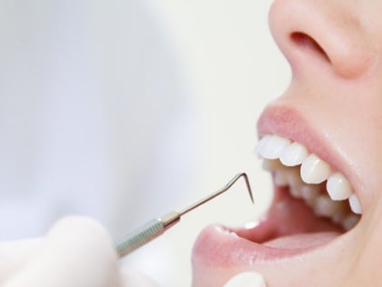 Специалисты центра «Стоматолог и я» рассказывают о появлении трещин на зубах