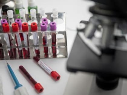 В Ростове заработает горячая линия по вопросам профилактики ВИЧ