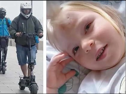 Новая транспортная реальность: самокат калечит детей