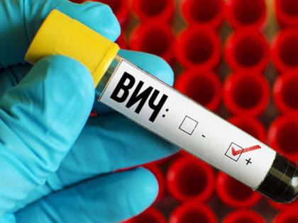 ВИЧ-инфекция - опаснейшее  заболевание