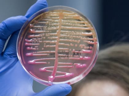 Условно-патогенный представитель бактерий группы кишечной палочки (БГКП)