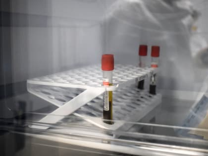 «Опасный укус»: как не заразиться лихорадкой Западного Нила от комара в Ростове