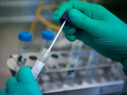 В Роспотребнадзоре опровергли информацию о холере в Ростовской области