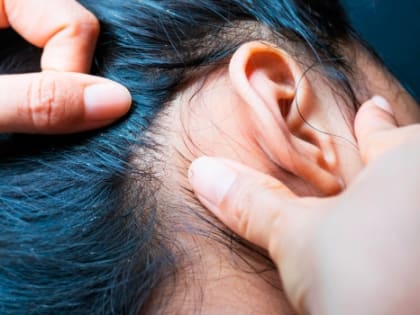 В Ростовской области почти в два раза снизилось количество заболевших педикулезом