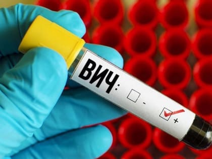 ВИЧ-инфекция - ситуация непростая