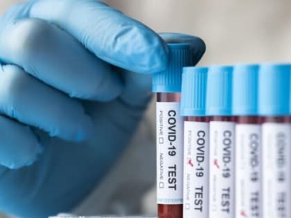 В Роспотребнадзоре рассказали о прививках от коронавируса в этом сезоне