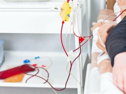 В Ростове врачи ОКДЦ рассказали, при каких заболеваниях назначают плазмаферез