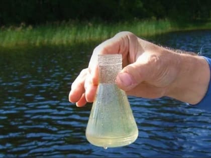 О профилактике кишечных инфекций, в том числе холеры, рассказали ростовские специалисты