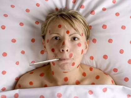 Ростовчан предупредили об опасности заражения корью