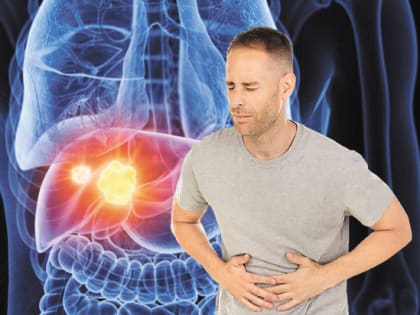 Опасные симптомы: ученые нашли первые признаки, возникающие за 2 года до агрессивного рака