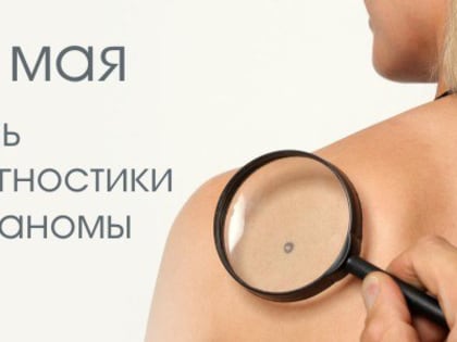 23 мая — День диагностики меланомы в России