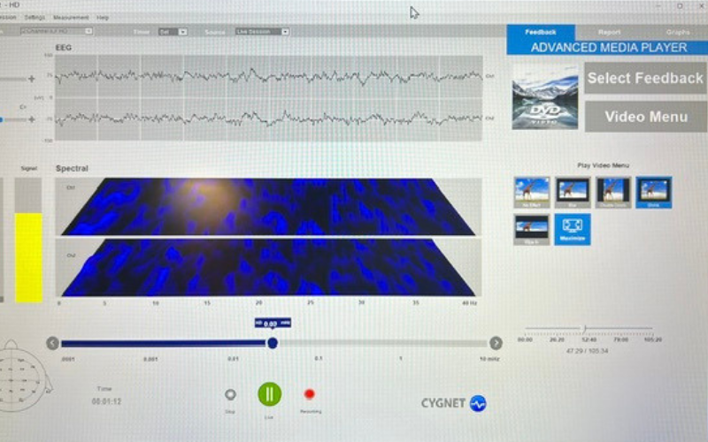 Live neurofeedback session showing real-time EEG and brain activity tracking
