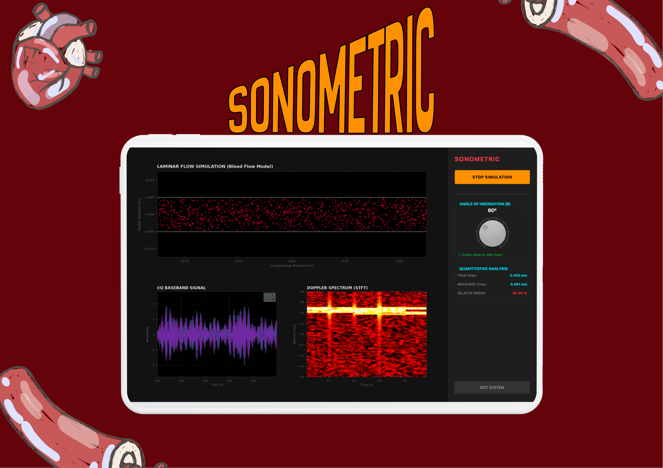 SonoMetric Overview